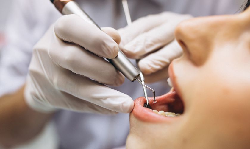tooth extraction in ludington
