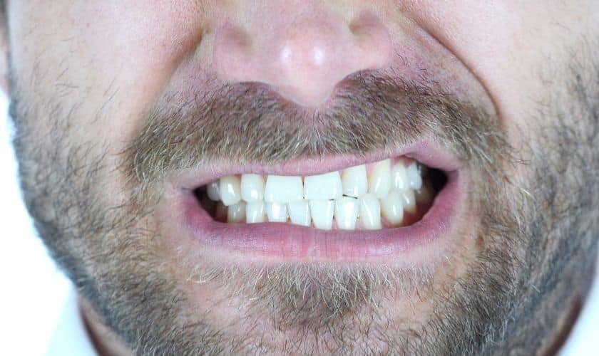 Teeth Grinding - Lakewinds Dental Centre