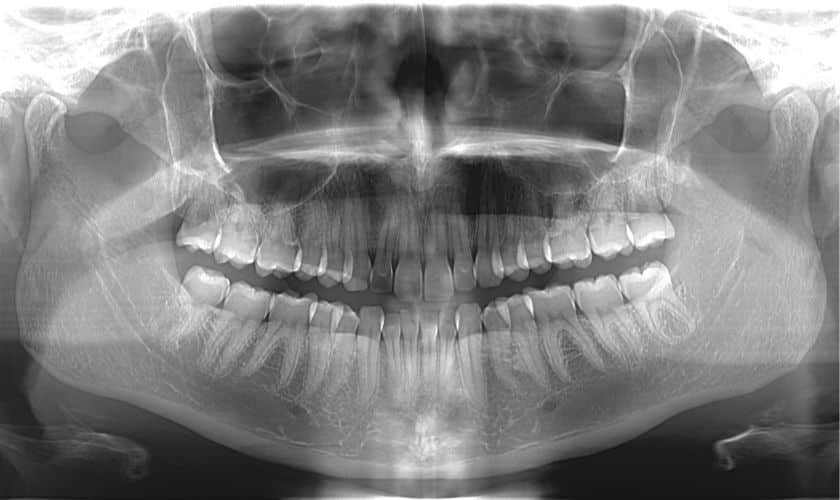 Cone Beam CT Imaging