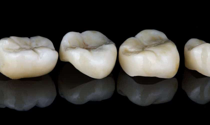 Whiten Dental Crown