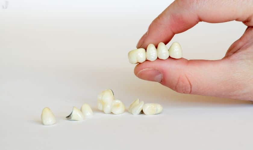 process of getting dental crown