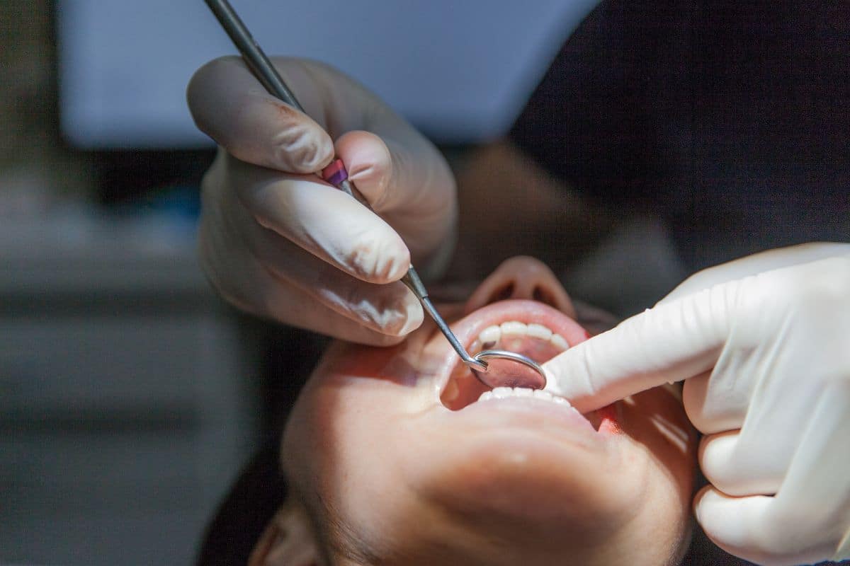 oral surgery in treating wisdom teeth
