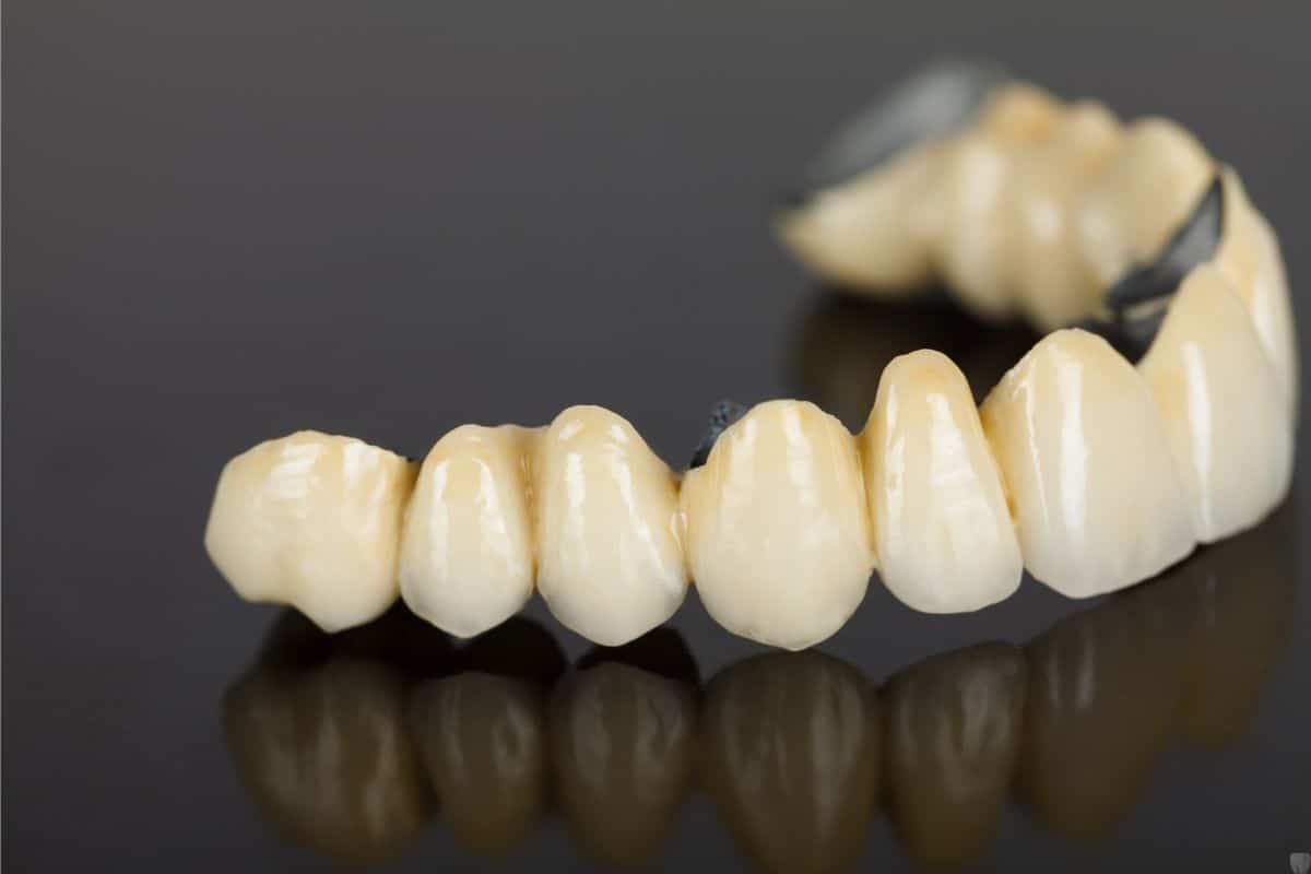 how do porcelain dental bridges work