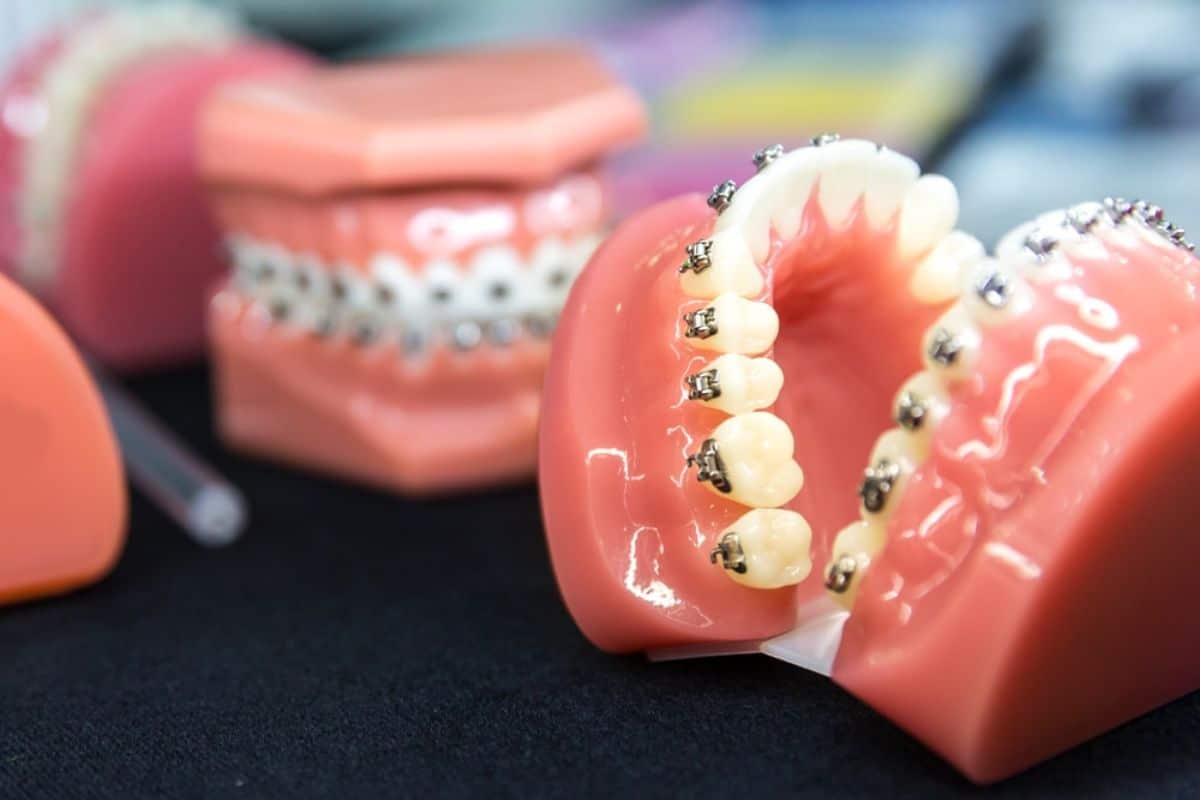 Orthodontics Treatment in Ludington