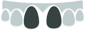 img gap teeth