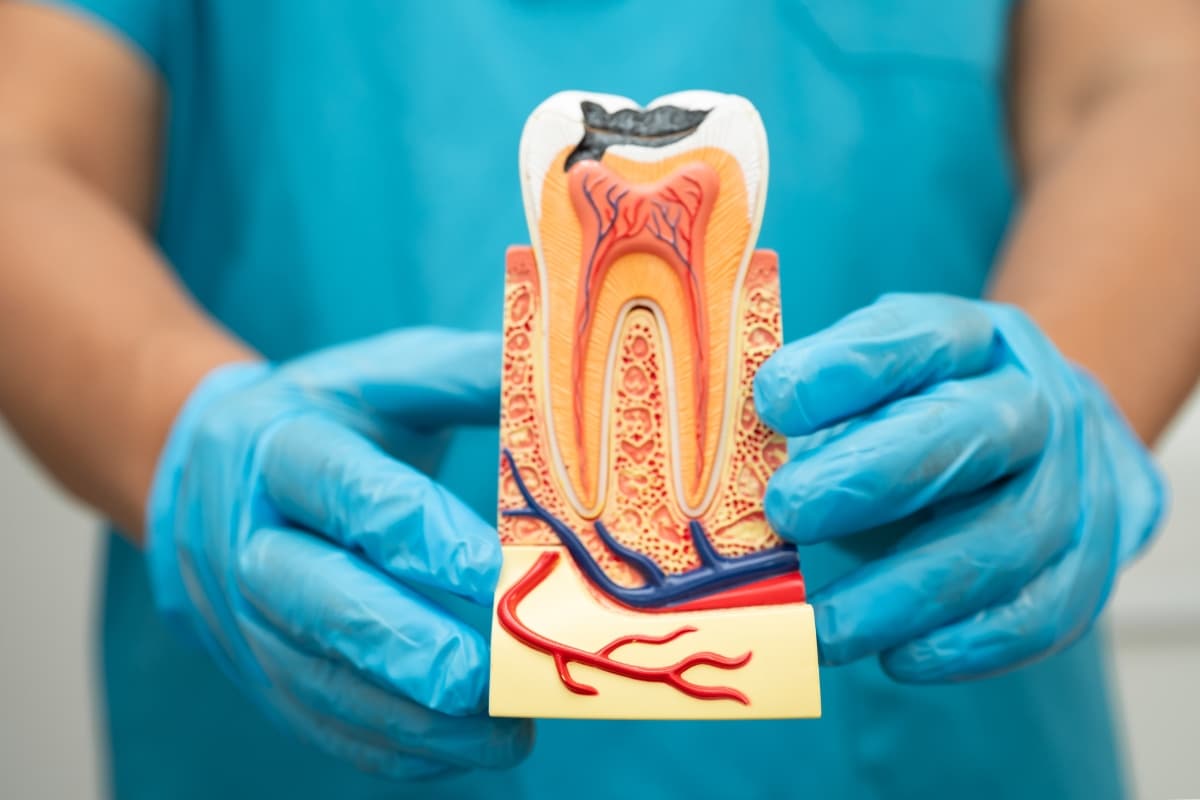 Nutrition Tips For Faster Dental Implant Healing