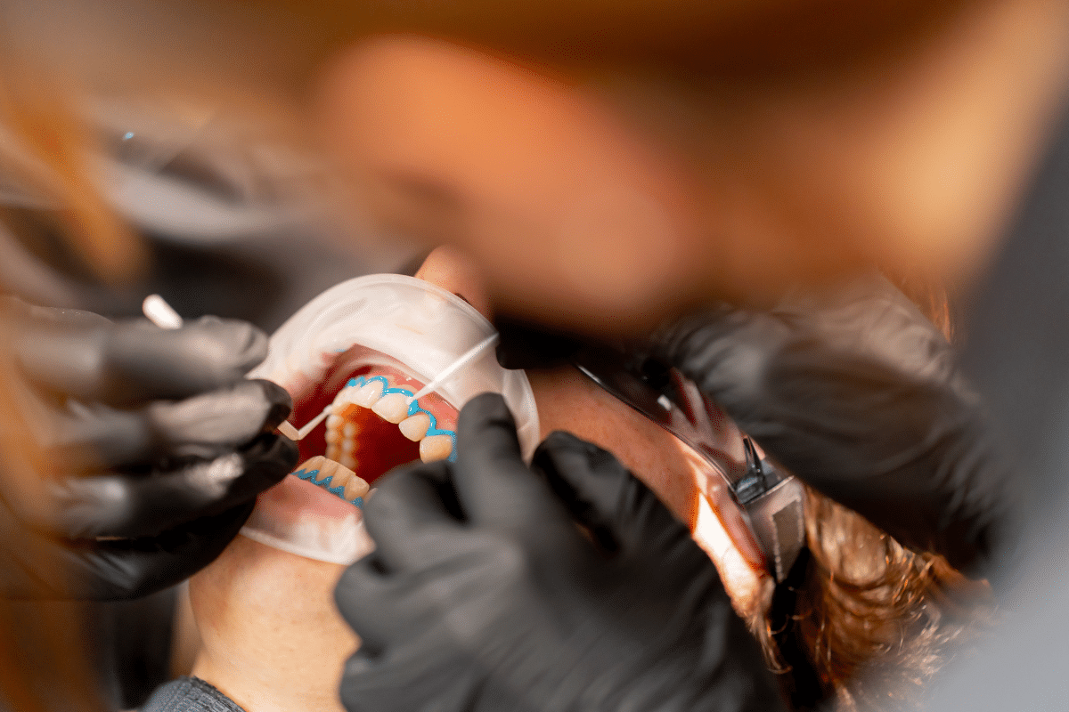 Are Cosmetic Dental Procedures Painful
