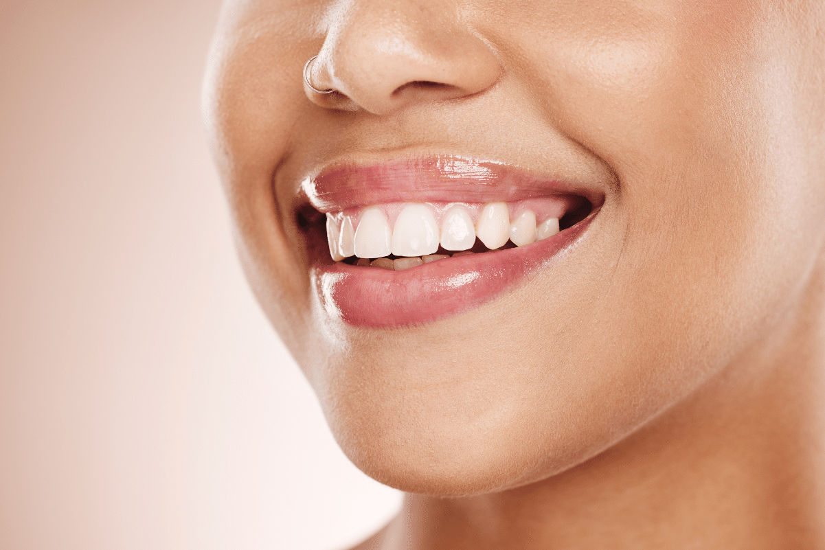 Right Cosmetic Dentist for Your Smile Goals