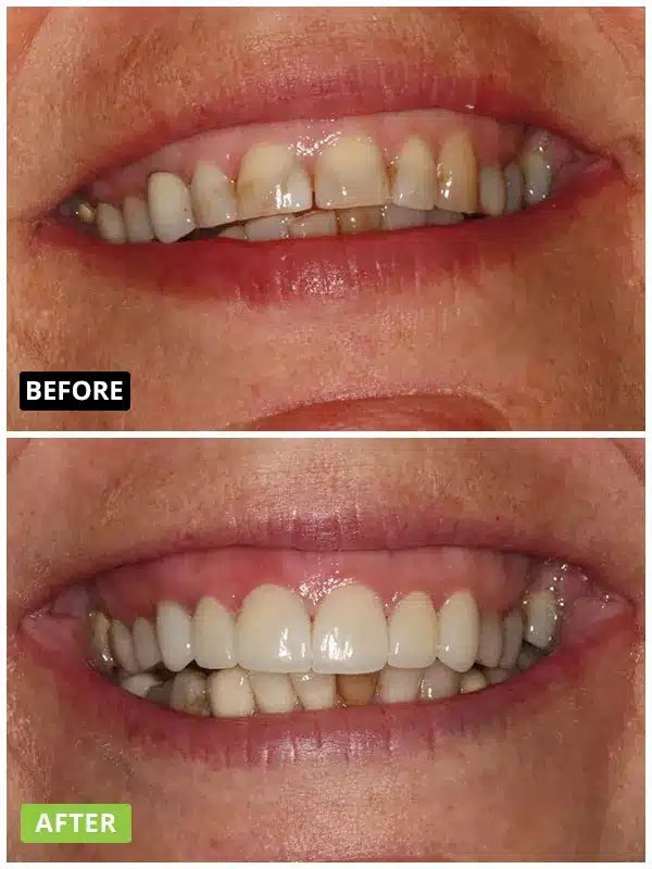 img Smile Gallery