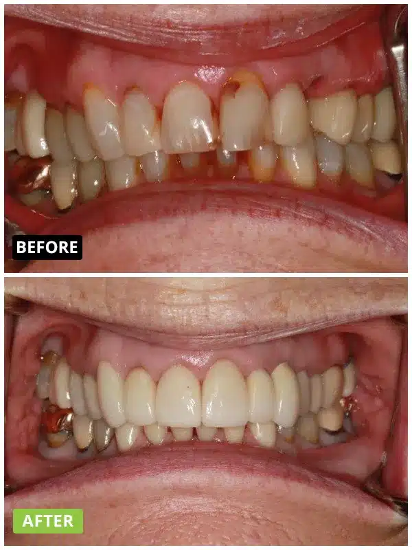 img before after