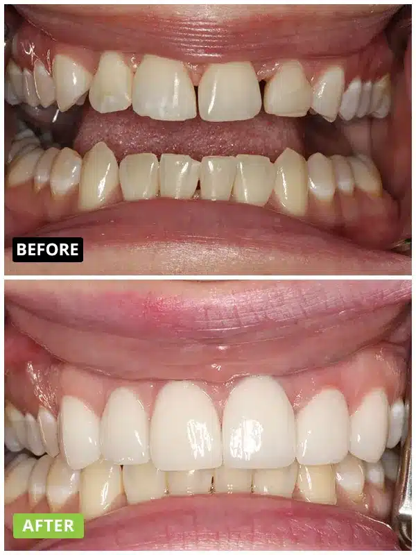 img dental result
